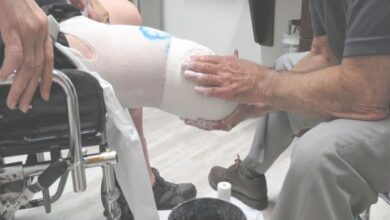 شہری نے انشورنس کی رقم حاصل کرنے کیلئے اپنی ہی ٹانگیں کٹوا دیں